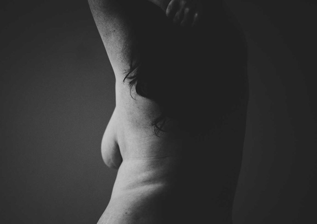 Réduction mammaire | Dr Silhol Paris