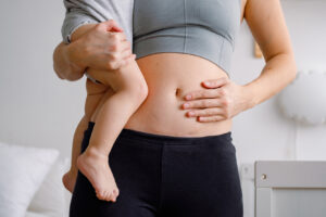 Abdominoplastie et césarienne | Dr Silhol | Montpellier et Paris